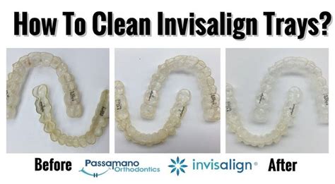 clean  crusty invisalign tray  retainer  home