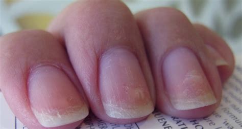 The 6 Most Annoying Problems You Have With Your Nails And
