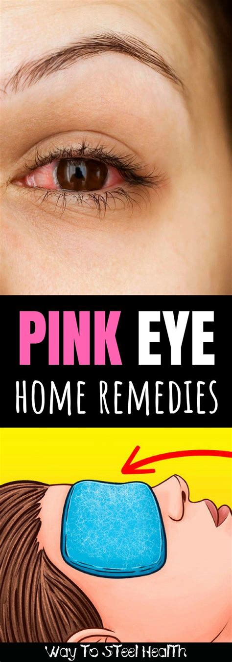 rid  pink eye fast    home remedies natural pink eye
