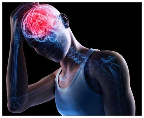brain scan reveals concussion effects science technology sottnet