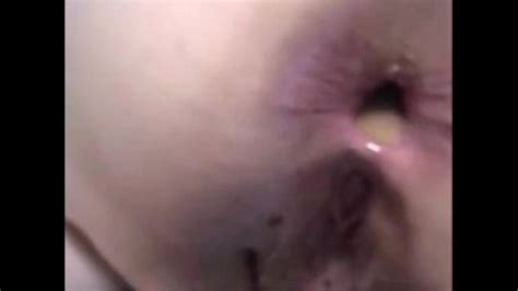 Son Give Mom Painful Anal Sex And A Anal Creampie Xnxx