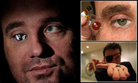 Canadian Man Rob Spence Replaces His Glass Eyeball With A Camera