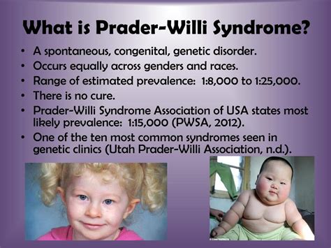 Prader Willi Syndrome Captions Omega
