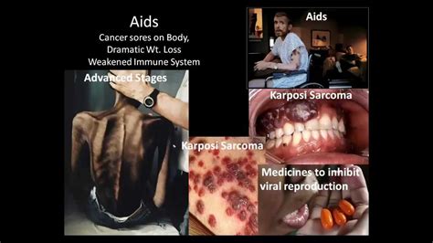 Sexually Transmitted Diseases Youtube