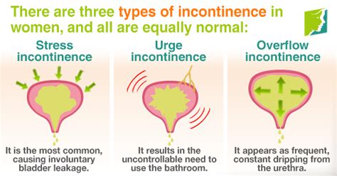 5 Little Known Facts About Incontinence In Women Menopause Now