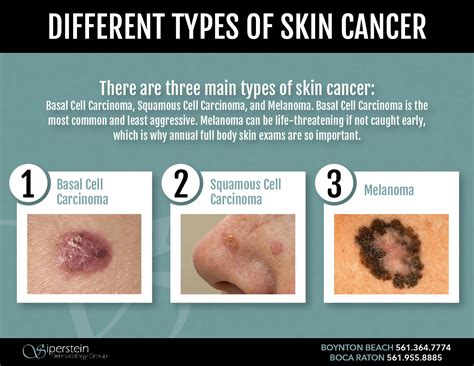 Most Common Type Of Skin Cancer Lance Embry