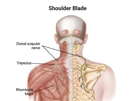 shoulder blade pain  guide  pain relief njs top orthopedic