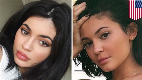 how did kylie jenner get rid of her lip fillers tomonews youtube