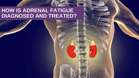 How Is Adrenal Fatigue Diagnosed And Treated Genesis Gold