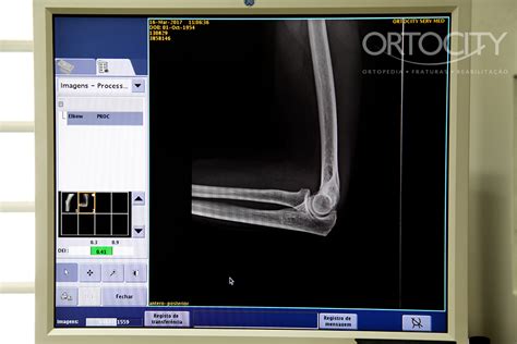 raio x digital ortocity clínica ortopédica e de reabilitação em são