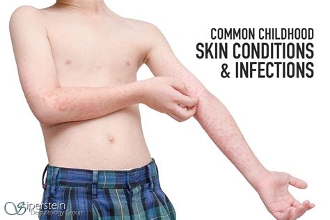 handy guide  common childhood viral skin conditions