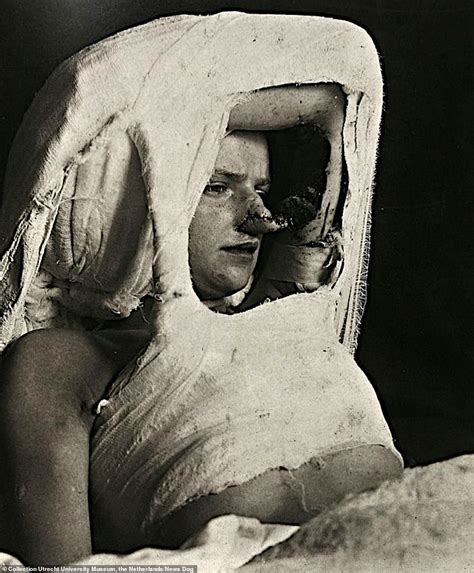 Haunting Medical Portraits Reveal Extreme Symptoms Suffered By Patients