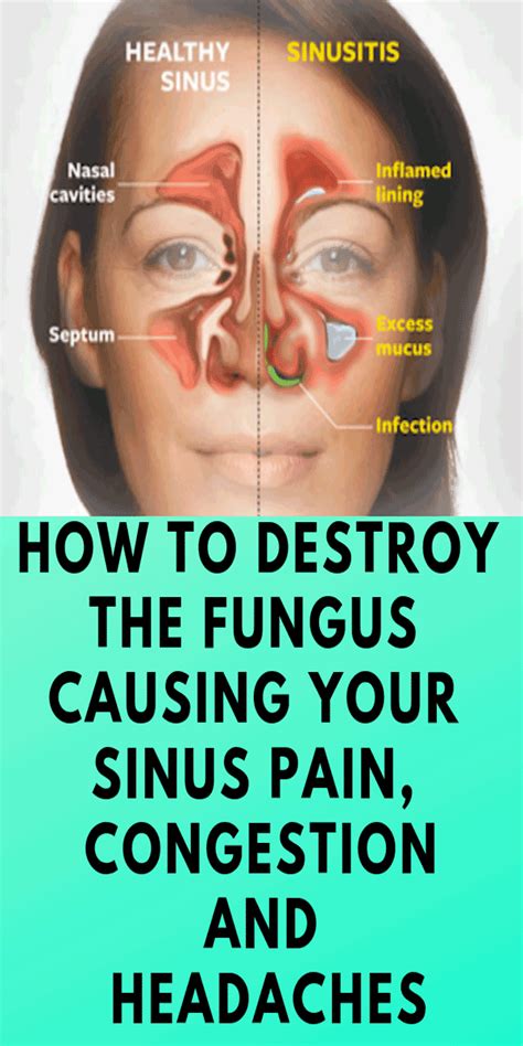 quick   drain sinuses   guide