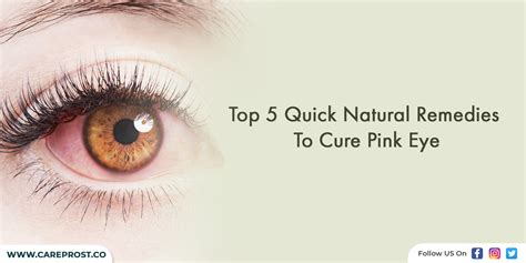top  quick natural remedies  cure pink eye