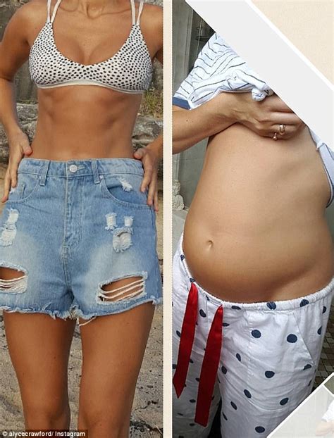 alyce crawford details the severe bloating she suffers