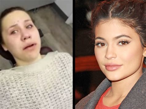 this teen woke up after surgery thinking she s kylie