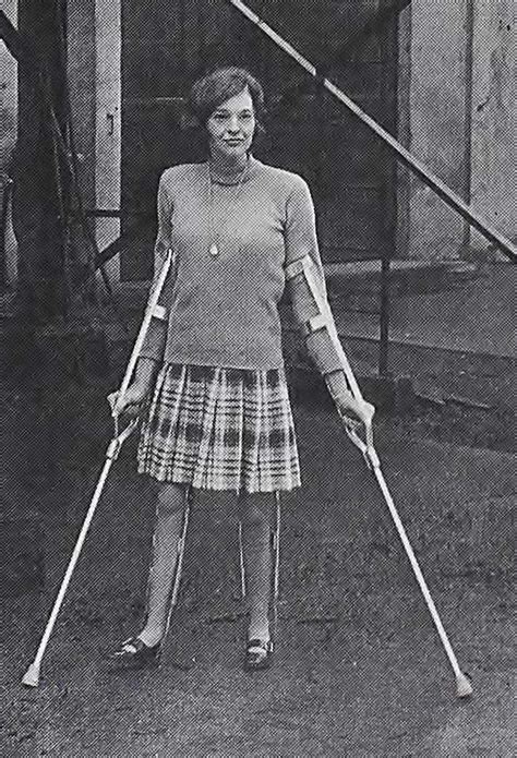 Jack Casts Blog — Vintage 1960s Polio Girl