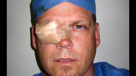 removal  eye patch   reaction  cataract surgery