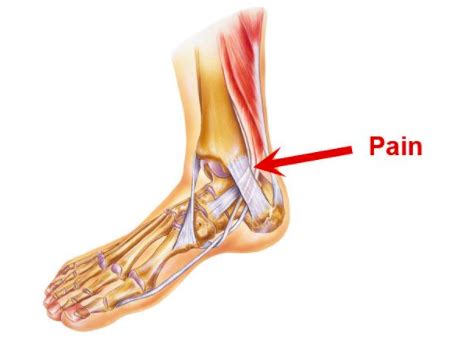 ankle pain  running capital physiotherapy