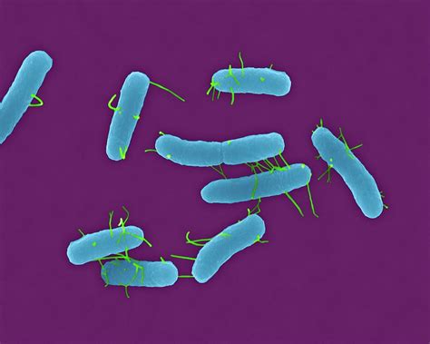 salmonella typhimurium  xld  microbe notes images   finder
