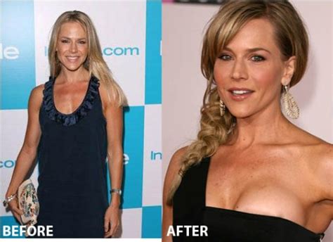 Julie Benz Plastic Surgery Before And After Botox And