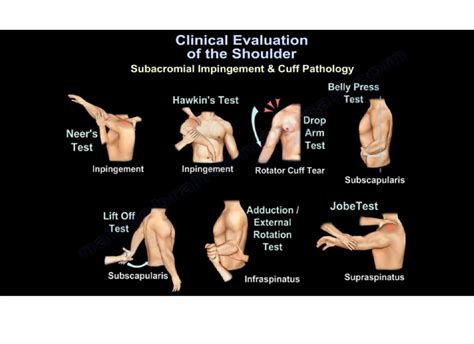 clinical evaluation   shoulder orthopaedicprinciplescom