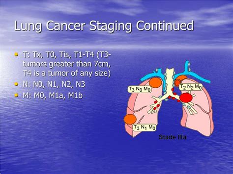 Ppt Lung Cancer Powerpoint Presentation Free Download Id 1492088