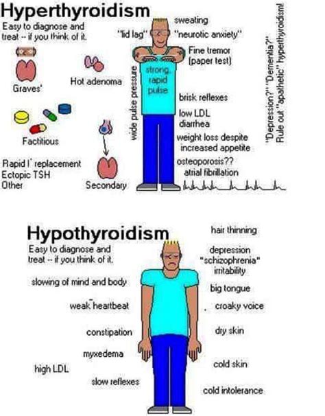 Hyperthyroidism Vs Hypothyroidism Medizzy
