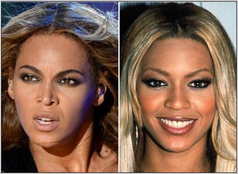 Beyonce Plastic Surgery Before After Plastic Surgery