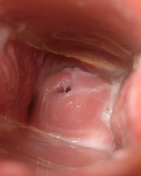 sperm inside cervix detail mega porn pics