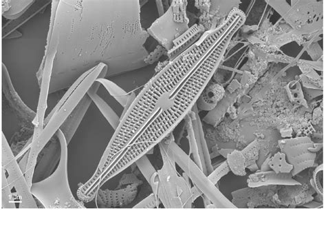 brachysira microcephala diatom flora  britain  ireland