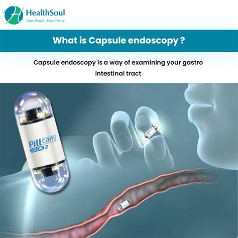 capsule endoscopy indications  complications healthsoul