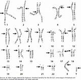Chromosomes Structure sketch template