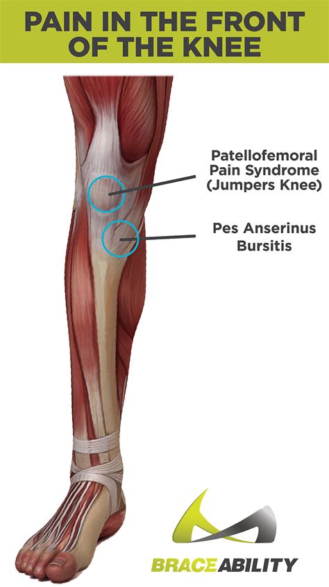 pain   side  knee cheap  save  jlcatjgobmx