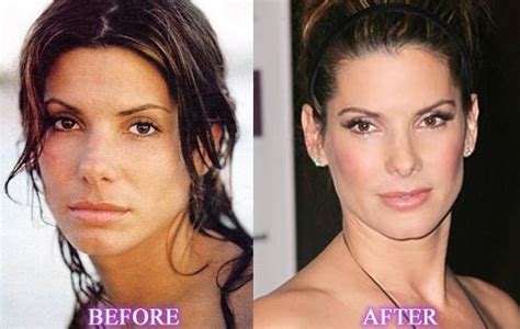 9 celebrities who had amazing plastic and cosmetic surgery