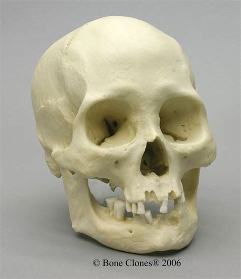 Museum Quality Modern Adult Skull Casts