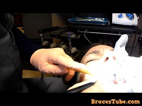 braces cleaning dental fetish eporner