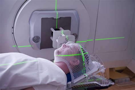 palliative radiation therapy  treatment  cancer