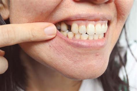 long term problems caused   missing tooth dental care
