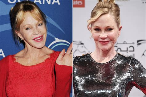 Melanie Griffith On Plastic Surgery ‘hopefully I Look More Normal Now