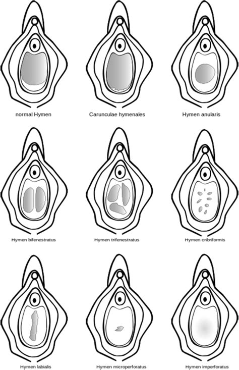 shows some of the different configurations of the hymen download