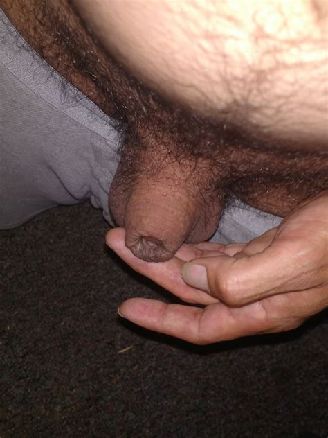 Tiny Circumcised Micro Penis 43 Pics Xhamster