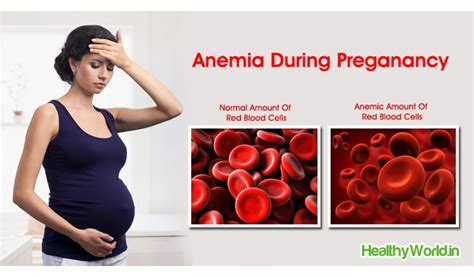 anemia pregnant anal mom pics
