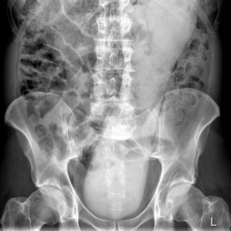 rectum fist dildo x ray 21 like ra s naughty blog