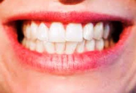 gambaran umum gigi manusia mitra kesmas