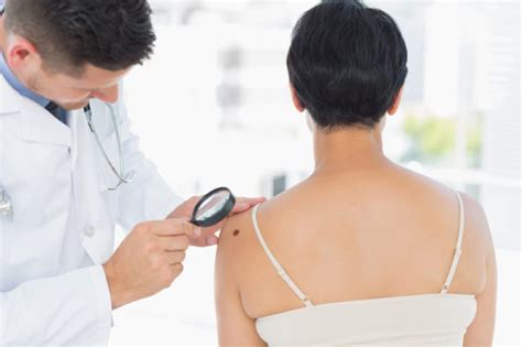 Skin Cancer Signs Self Checks May Help You Avoid Deadly Recurrence