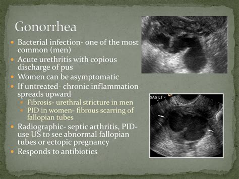 Ppt Dmi 56 Ch 11~ Reproductive System Powerpoint Presentation Free