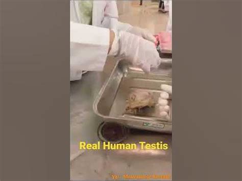 anatomy  human testis real human testis anatomy youtube