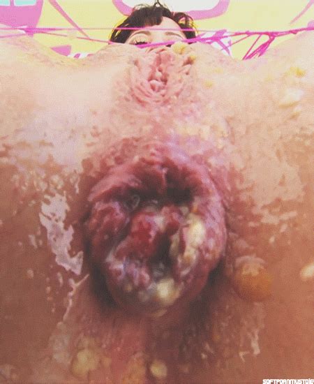 tumbex anal
