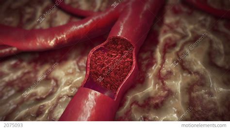 blood clot stock animation